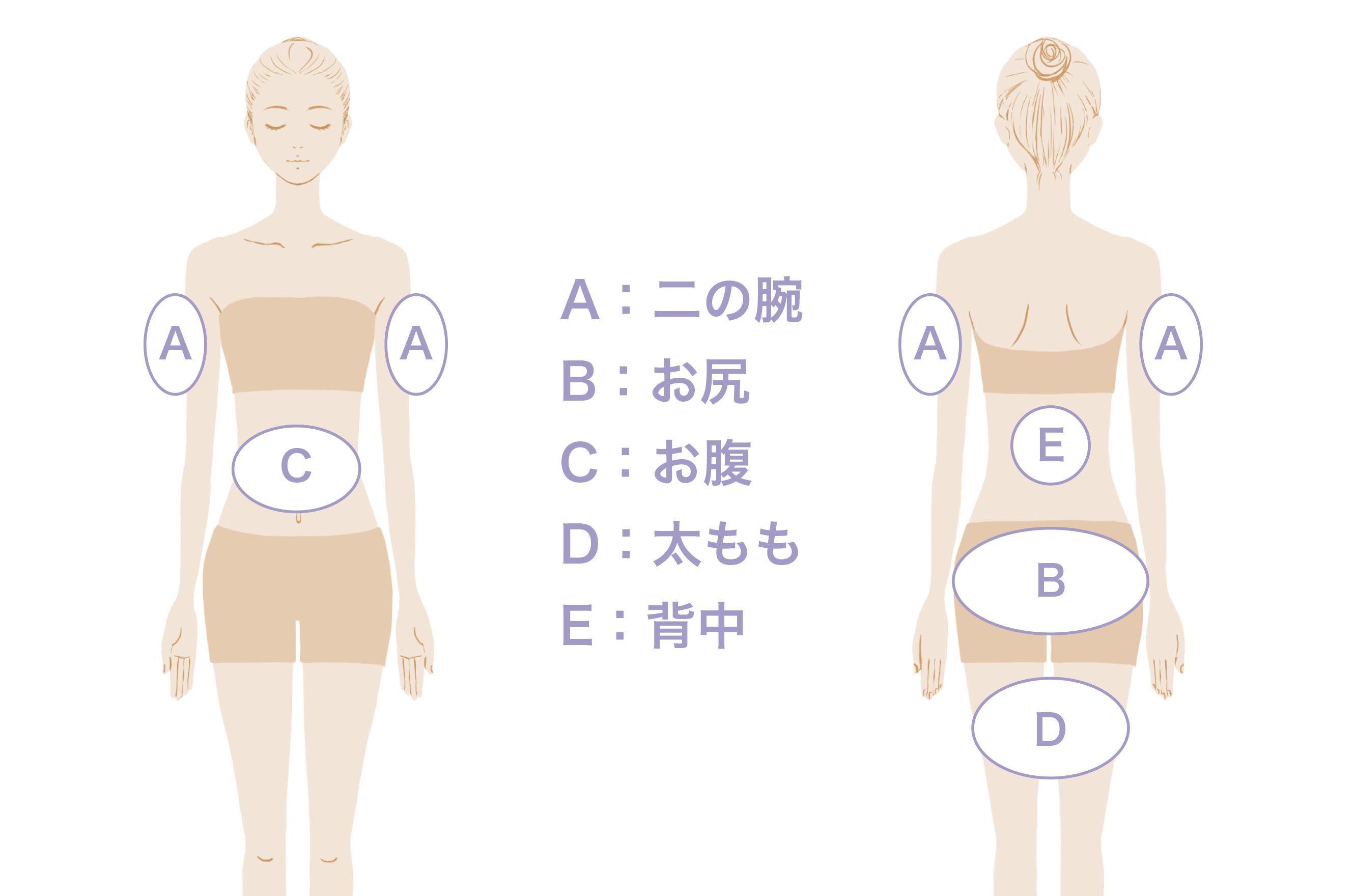 HIFU（ハイフ）ボディ施術箇所