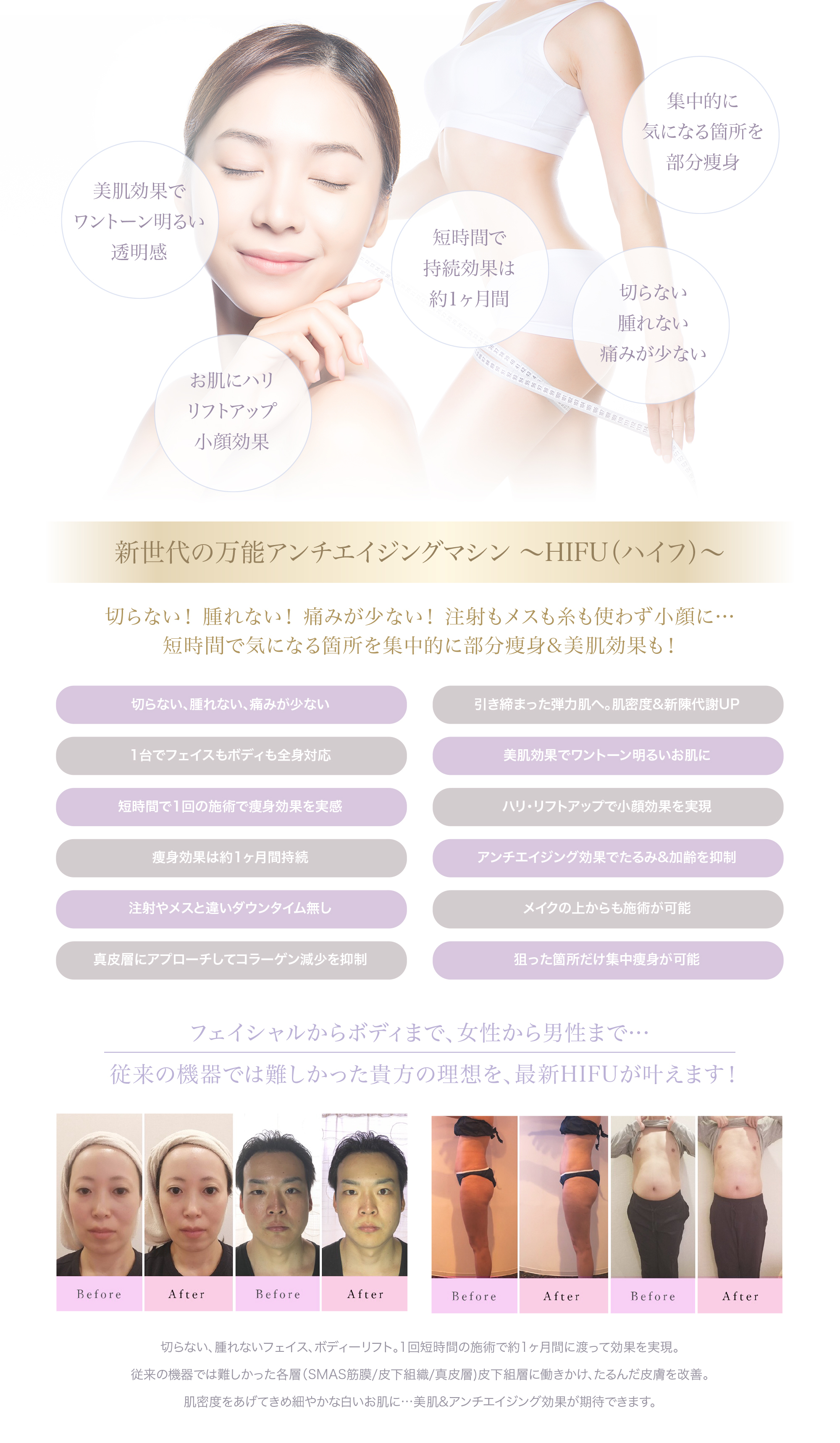 HIFU(ハイフ)説明